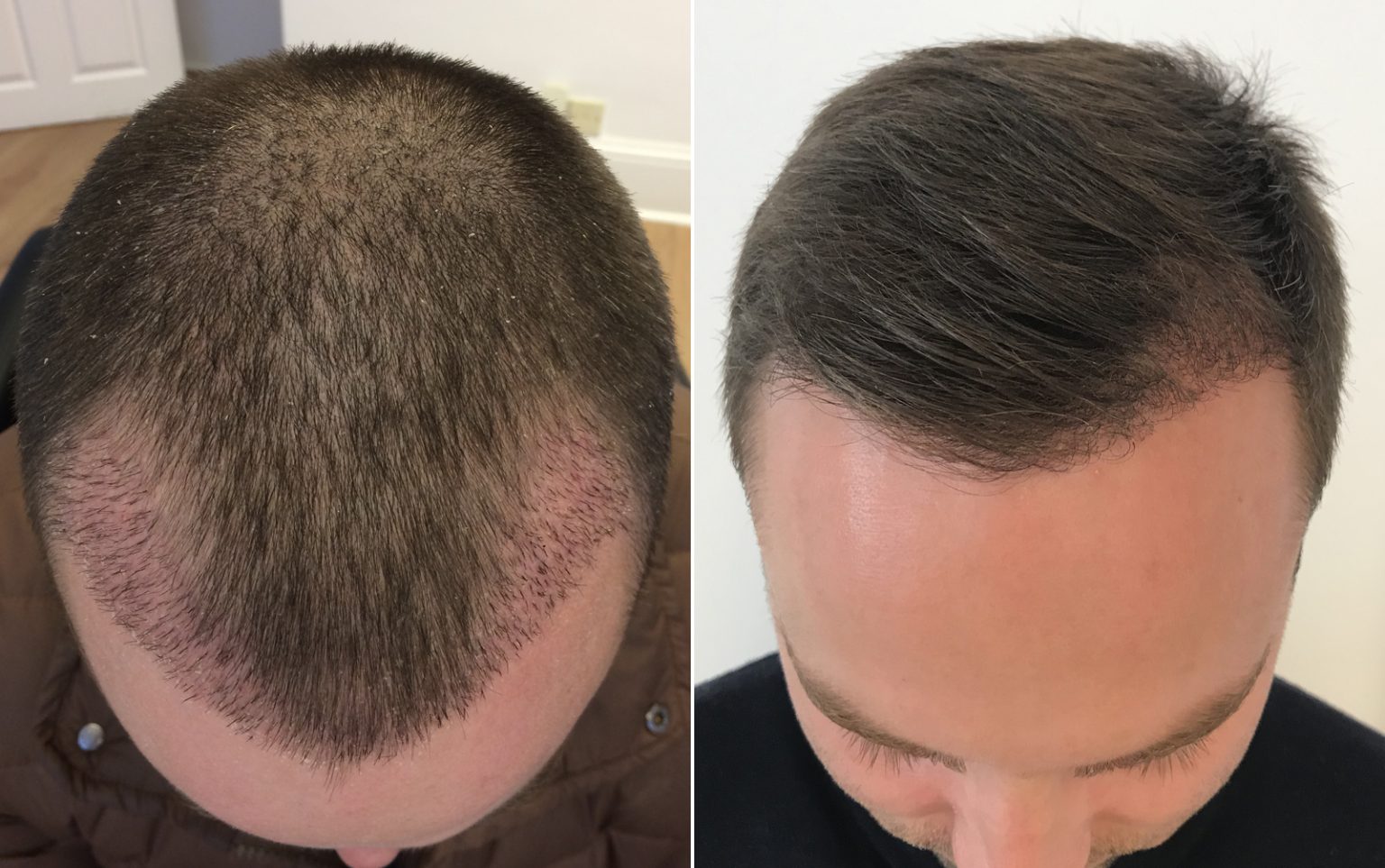elliot_before and after International Hair Studio